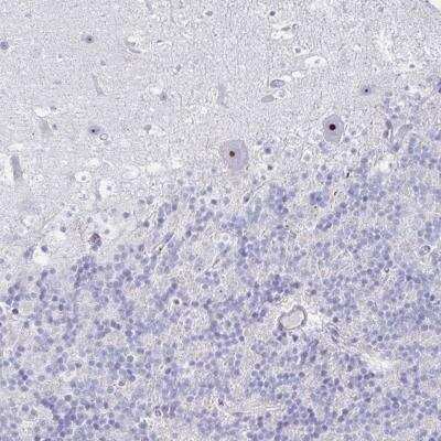 Immunohistochemistry-Paraffin: DLK2/EGFL9 Antibody [NBP2-31847] - DLK2 Antibody [NBP2-31847] - Staining of human cerebellum shows strong nucleolar positivity in Purkinje cells.
