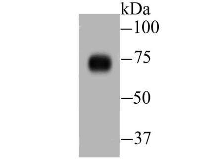 Western Blot: DLL4 Antibody [NBP2-89151] - Analysis of DLL4 on human lung tissue lysate using anti-DLL4 antibody at 1/500 dilution.
