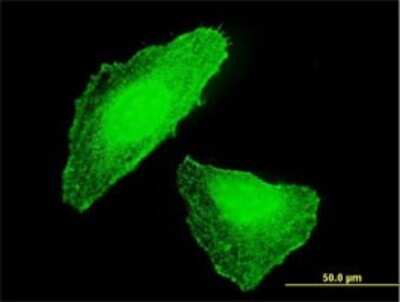 Immunocytochemistry/Immunofluorescence: DLX5 Antibody (1B3) [H00001749-M01] - Analysis of monoclonal antibody to DLX5 on HeLa cell . Antibody concentration 10 ug/ml.
