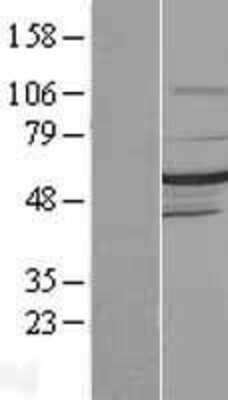 Western Blot: DMAP1 Overexpression Lysate (Adult Normal) [NBL1-09922] Left-Empty vector transfected control cell lysate (HEK293 cell lysate); Right -Over-expression Lysate for DMAP1.