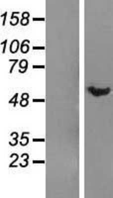 Western Blot: DMAP1 Overexpression Lysate (Adult Normal) [NBP2-08554] Left-Empty vector transfected control cell lysate (HEK293 cell lysate); Right -Over-expression Lysate for DMAP1.