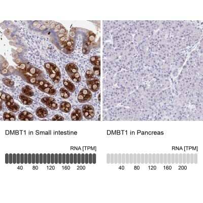 <b>Orthogonal Strategies Validation. </b>Immunohistochemistry-Paraffin: DMBT1/GP340 Antibody [NBP2-38471] - Analysis in human small intestine and pancreas tissues. Corresponding DMBT1 RNA-seq data are presented for the same tissues.