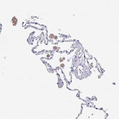 Immunohistochemistry-Paraffin: DMBT1/GP340 Antibody [NBP2-38471] - Staining of human lung shows weak cytoplasmic positivity in macrophages.