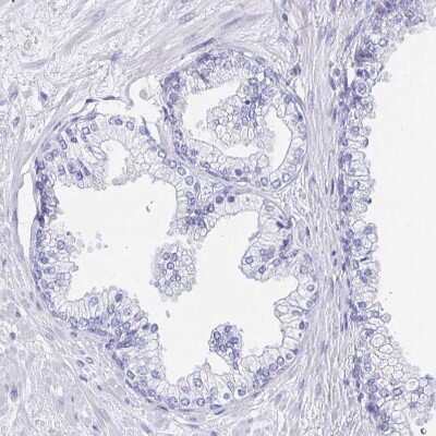 Immunohistochemistry-Paraffin: DMBT1/GP340 Antibody [NBP2-38471] - Staining of human prostate shows no positivity in glandular cells as expected.