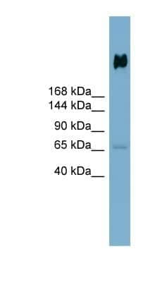 Western Blot: DMBT1/GP340 Antibody [NBP1-57668] - Human Stomach, concentration 0.2-1 ug/ml.