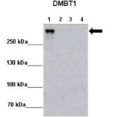 Western Blot: DMBT1/GP340 Antibody [NBP1-57668] - Lanes: Lane 1 : 2ug MCF7-DMBT1+Dox Lane 2: 2ug MCF7-DMBT1 -Dox Lane 3: 2ug MCF7-Ctrl+Dox Lane 4: 2ug MCF7-DMBT1 -Dox Primary, Antibody Dilution: 1 : 5000 Secondary Antibody: Anti-rabbit HRP Secondary, Antibody Dilution: 1 : 10,000 Gene name: DMBT1.