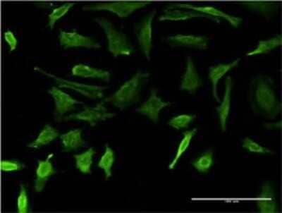 Immunocytochemistry/Immunofluorescence: DMP-1 Antibody (1D4) [H00001758-M01] - Analysis of monoclonal antibody to DMP1 on HeLa cell . Antibody concentration 10 ug/ml.