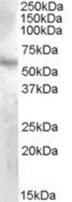 Western Blot: DMP-1 Antibody [NBP1-20908] - (1ug/ml) staining of Human Kidney lysate (35ug protein in RIPA buffer). Primary incubation was 1 hour. Detected by chemiluminescence.