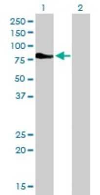 Western Blot: DMPK Antibody (2F7) [H00001760-M01] - Analysis of DMPK expression in transfected 293T cell line by DMPK monoclonal antibody (M01), clone 2F7.Lane 1: DMPK transfected lysate(69.4 KDa).Lane 2: Non-transfected lysate.