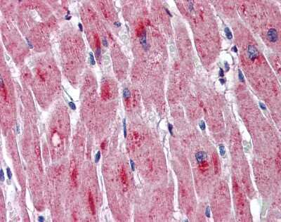 Immunohistochemistry-Paraffin: DMPK Antibody [NBP1-57584] - Human Heart Tissue, antibody concentration 5 ug/ml.