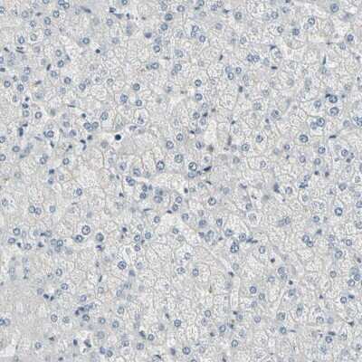 Immunohistochemistry-Paraffin DMPK Antibody