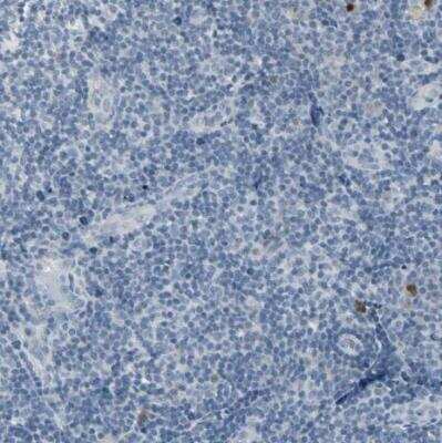 Immunohistochemistry-Paraffin DMPK Antibody