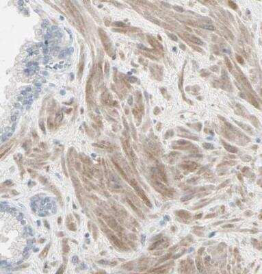 Immunohistochemistry-Paraffin DMPK Antibody