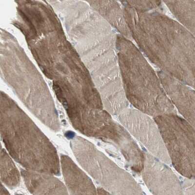 Immunohistochemistry-Paraffin: DMPK Antibody [NBP1-85011] - Staining of human skeletal muscle shows moderate cytoplasmic positivity in myocytes.