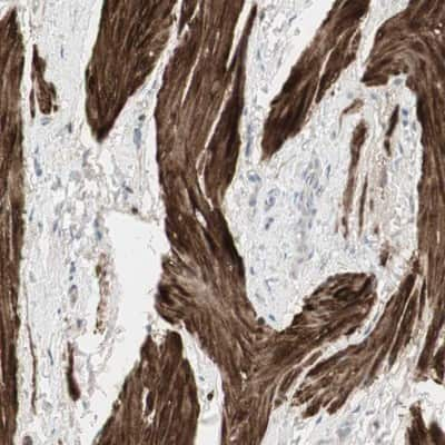 Immunohistochemistry-Paraffin: DMPK Antibody [NBP1-85011] - Staining of human smooth muscle shows high expression.