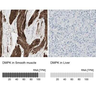 <b>Orthogonal Strategies Validation. </b>Immunohistochemistry-Paraffin: DMPK Antibody [NBP1-85011] - Staining in human smooth muscle and liver tissues using anti-DMPK antibody. Corresponding DMPK RNA-seq data are presented for the same tissues.