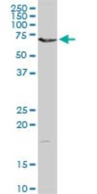 Western Blot: DMPK Antibody [H00001760-D01P] - Analysis of DMPK expression in HeLa.