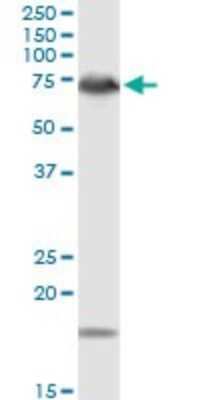 Western Blot: DMPK Antibody [H00001760-D01P] - Analysis of DMPK expression in PC-12.
