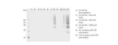 Western Blot: DMPO Nitrone Adduct Antibody (N1664A) [NBP2-59306] - Analysis of Human HL 60 clone 15 eosinophils lysates showing detection of DMPO protein using Mouse Anti-DMPO Monoclonal Antibody, Clone N1664A. Primary Antibody: Mouse Anti-DMPO Monoclonal Antibody at 1:200.