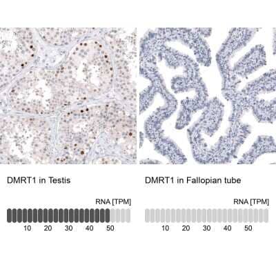 Immunohistochemistry-Paraffin: DMRT1 Antibody [NBP1-84071] - Analysis in human testis and fallopian tube tissues. Corresponding DMRT1 RNA-seq data are presented for the same tissues.