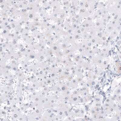 Immunohistochemistry-Paraffin: DMRT1 Antibody [NBP1-84071] - Staining of human liver shows no positivity in hepatocytes as expected.