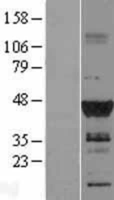 Western Blot: DMRT1 Overexpression Lysate (Adult Normal) [NBL1-09925] Left-Empty vector transfected control cell lysate (HEK293 cell lysate); Right -Over-expression Lysate for DMRT1.