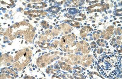 Immunohistochemistry: DMRT2 Antibody [NBP2-82871] - Human kidney