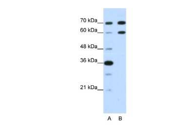 Western Blot: DMRT2 Antibody [NBP2-82871] - WB Suggested Anti-DMRT2 Antibody Titration: 1.25ug/ml. Positive Control: HepG2 cell lysate