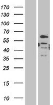 Western Blot: DMRT2 Overexpression Lysate (Adult Normal) [NBP2-04871] Left-Empty vector transfected control cell lysate (HEK293 cell lysate); Right -Over-expression Lysate for DMRT2.