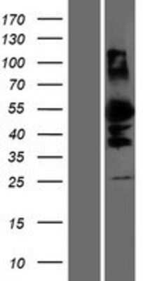 Western Blot DMRTA1 Overexpression Lysate