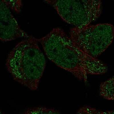 Immunocytochemistry/ Immunofluorescence DMRTA2 Antibody - BSA Free