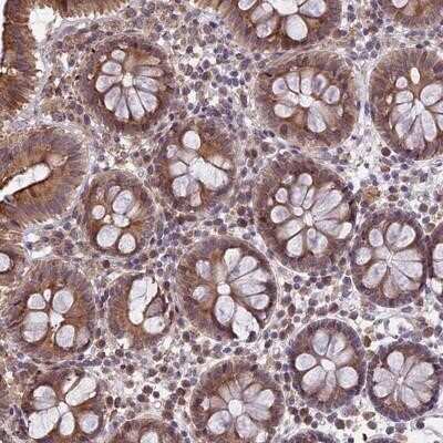 Immunohistochemistry-Paraffin: DMRTA2 Antibody [NBP1-85830] - Staining of human colon shows moderate cytoplasmic positivity in glandular cells.