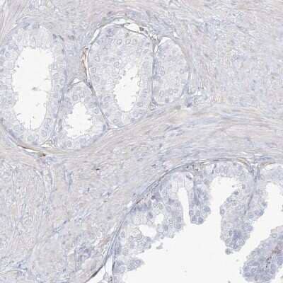 Immunohistochemistry-Paraffin DMRTB1 Antibody - BSA Free