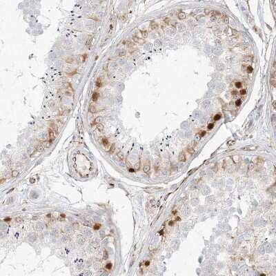 Immunohistochemistry-Paraffin DMRTB1 Antibody - BSA Free