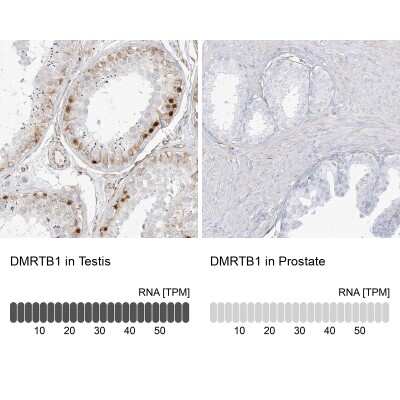 Immunohistochemistry-Paraffin DMRTB1 Antibody - BSA Free