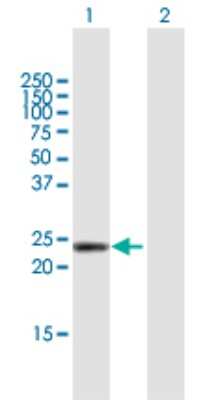 Western Blot: DMRTB1 Antibody [H00063948-B02P] - Analysis of DMRTB1 expression in transfected 293T cell line by DMRTB1 polyclonal antibody.  Lane 1: DMRTB1 transfected lysate(20.10 KDa). Lane 2: Non-transfected lysate.