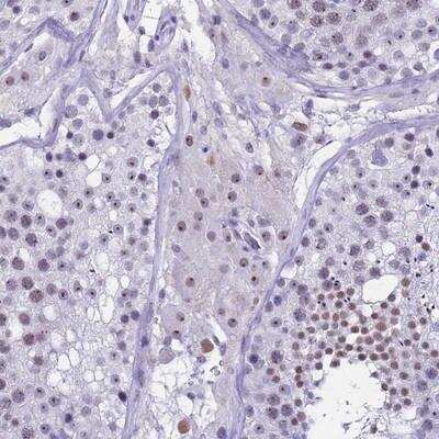 Immunohistochemistry-Paraffin DMRTC2 Antibody - BSA Free