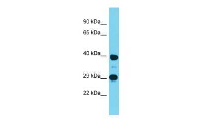 Western Blot: DMRTC2 Antibody [NBP2-87280] - Host: Rabbit. Target Name: Dmrtc2. Sample Type: Mouse Stomach lysates. Antibody Dilution: 1.0ug/ml