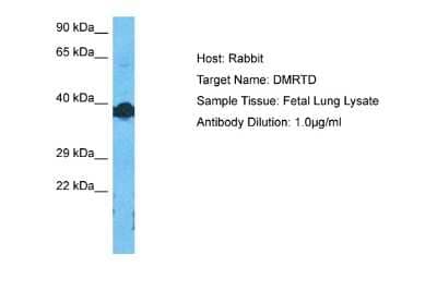 Western Blot: DMRTC2 Antibody [NBP2-87281] - Host: Rabbit. Target Name: DMRTD. Sample Type: Fetal Lung lysates. Antibody Dilution: 1.0ug/ml