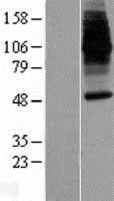 Western Blot NRAMP2/SLC11A2/DMT1 Overexpression Lysate