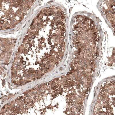 Immunohistochemistry-Paraffin: DMXL1 Antibody [NBP1-90998] - Staining of human testis shows moderate to strong cytoplasmic positivity in cells in seminiferous ducts.