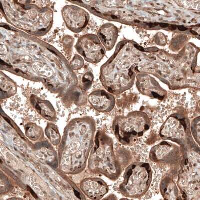 Immunohistochemistry-Paraffin: DMXL1 Antibody [NBP1-90998] - Staining of human placenta shows strong cytoplasmic positivity in cytotrophoblast.
