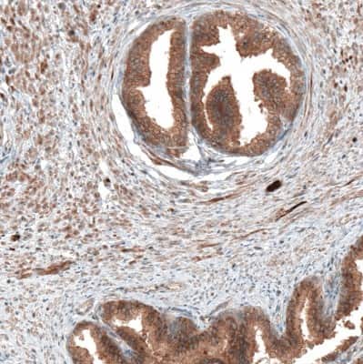 Immunohistochemistry-Paraffin: DMXL1 Antibody [NBP1-90998] - Staining of human prostate shows moderate to strong cytoplasmic positivity in glandular cells.