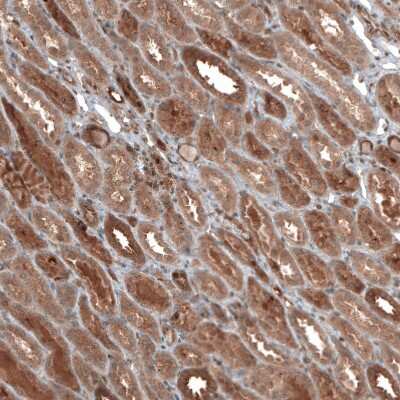 Immunohistochemistry-Paraffin: DMXL1 Antibody [NBP1-90998] - Staining of human kidney shows moderate to strong cytoplasmic positivity in cells in tubules.
