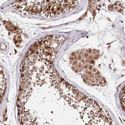 Immunohistochemistry-Paraffin DMXL1 Antibody - BSA Free