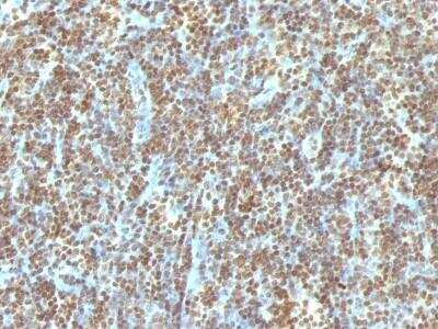 Immunohistochemistry-Paraffin: DNA Antibody (121-3) - Azide and BSA Free [NBP2-78054] - Human Tonsil stained with Double Stranded DNA Monoclonal Antibody (121-3)