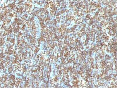 Immunohistochemistry-Paraffin: DNA Antibody (121-3) - IHC-Prediluted [NBP2-48325] - Formalin-fixed, paraffin-embedded human Tonsil.