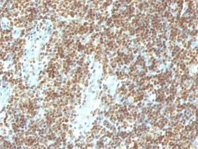 Immunohistochemistry-Paraffin: DNA Antibody (DSD/958) - IHC-Prediluted [NBP2-48142] - Human Tonsil stained with Double Stranded DNA Monoclonal Antibody (DSD/958)