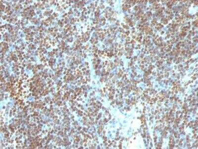 Immunohistochemistry-Paraffin: DNA Antibody (SPM603) - IHC-Prediluted [NBP2-48326] - Formalin-fixed, paraffin-embedded human Tonsil.