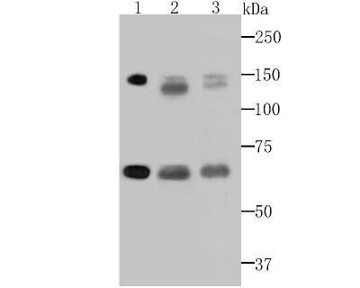 Western Blot: DNA Ligase I Antibody (JB43-39) [NBP2-75473] - Analysis of DNA Ligase I on different cell lysates using anti-DNA Ligase I antibody at 1/500 dilution.Positive control:Lane 1: Daudi     Lane 2: A431Lane 3: MCF-7